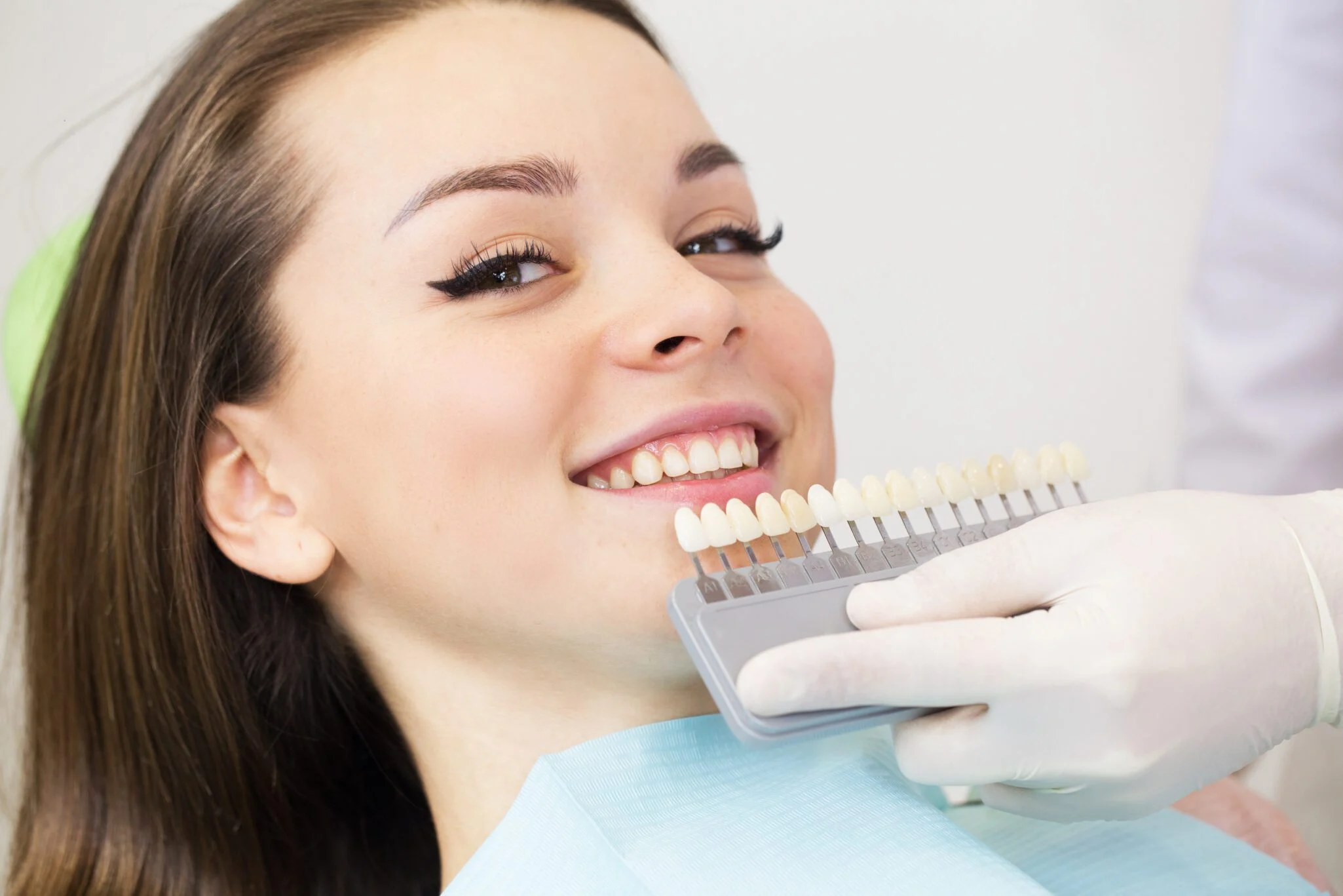 Composite bonding results at MDRN Dental Studio in McKinney, TX